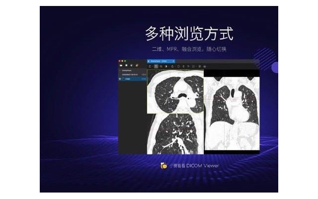 小赛看看dicom viewer医学影像软件官方版